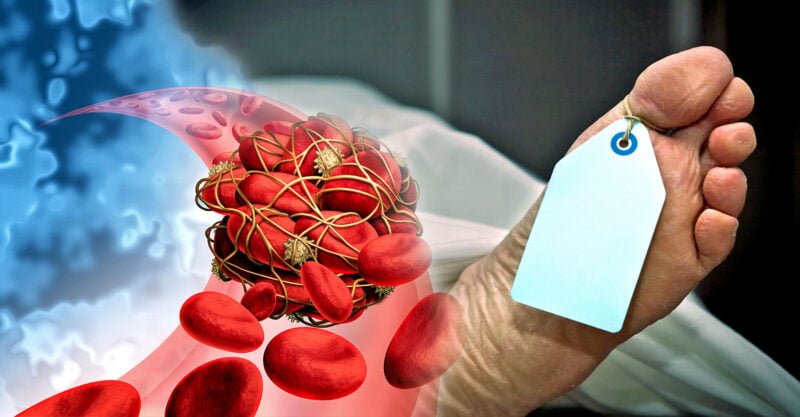 70% of embalmers report finding strange blood clots by mid-2021.