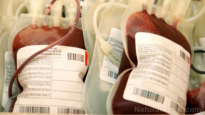 ¿Bancos de sangre no vacunados?  Conozca el creciente movimiento a favor de las transfusiones de sangre limpia