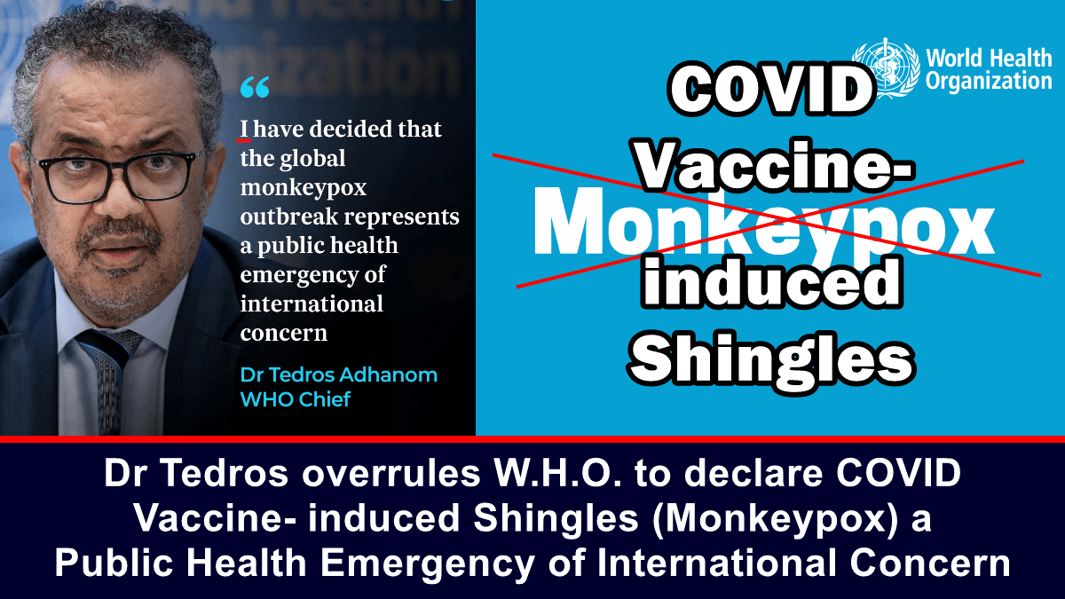 Tedros annulla l'OMS per dichiarare l'herpes zoster (vaiolo delle scimmie) causato dal vaccino COVID un'emergenza di salute pubblica internazionale